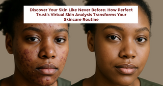 Discover Your Skin Like Never Before: How Perfect Trust’s Virtual Skin Analysis Transforms Your Skincare Routine