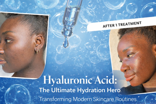Hyaluronic Acid: The Ultimate Hydration Hero Transforming Modern Skincare Routines