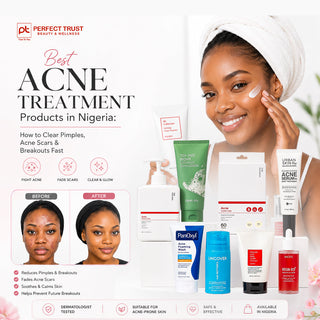 Best Acne Treatment Products in Nigeria: How to Clear Pimples, Acne Scars & Breakouts Fast