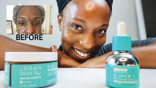 The Best Serums for Uneven Skin Tone: Urban Skin Rx Solutions That Work