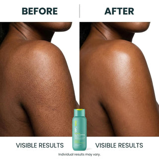 Urban Skin Rx Even Tone AHA Smoothing Body Wash 384ml