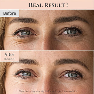 Beauty of Joseon Revive Eye Serum with Retinal Niacinamide Correction for Puffy Eye Bags Fine Lines Dark Circles Wrinkles, Korean Skin Care 30ml,